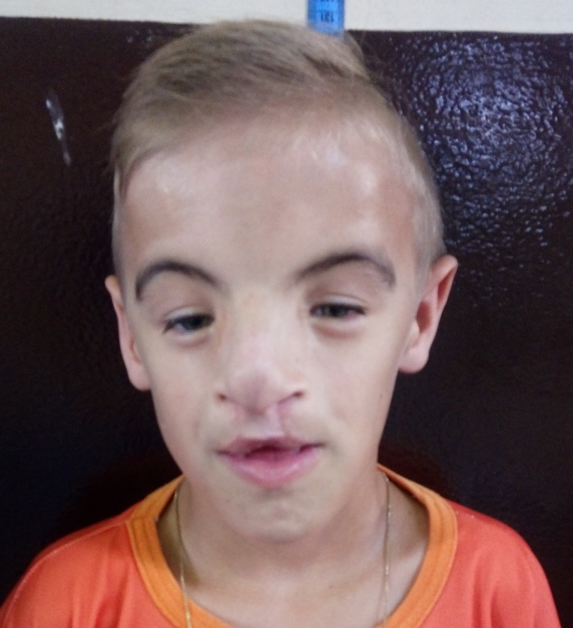 Bola pra Cima
